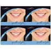 Medical Arts Press Dental Laser Postcards Photo Image Postcards; For Laser Printer; Sparkle And Glow, 100/Pk