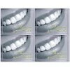 Medical Arts Press Dental Laser Postcards Photo Image Postcards; For Laser Printer; "Show Us Your Smile!", 100/Pk -Epson Shop s0842221 s7